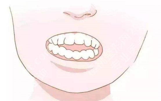 大牙镶牙好还是种植牙好呢？种植牙调节周期比较长费用相对较高！