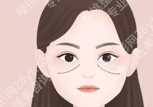 苹果肌断层怎么自我修复?有哪些原因会引起?