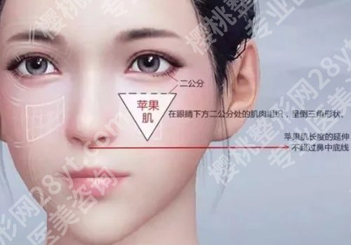 苹果肌断层怎么自我修复?有哪些原因会引起?