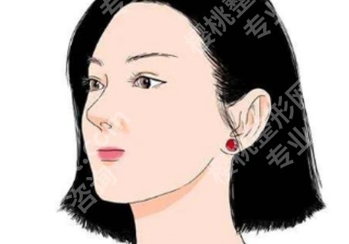 垫鼻基底前后对比照,变化竟然这么大!