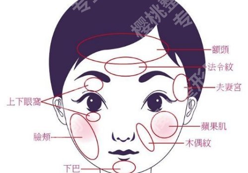 面颊凹陷怎么恢复饱满?这些方法你知道吗?
