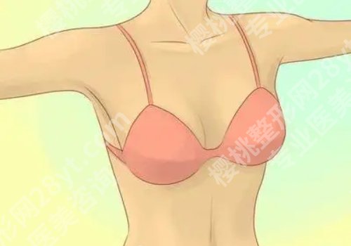 假体丰胸的价格怎样?术后怎么做好护理工作?