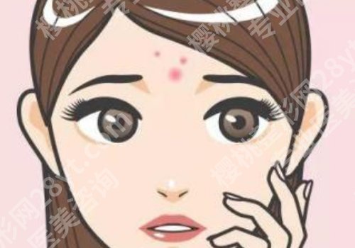 发际线附近长痘痘是啥原因?怎么消除呢?