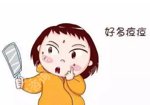 发际线附近长痘痘是啥原因?怎么消除呢?
