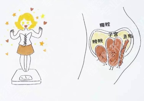盘底肌修复有哪些方式?这篇内容有你想了解的信息!