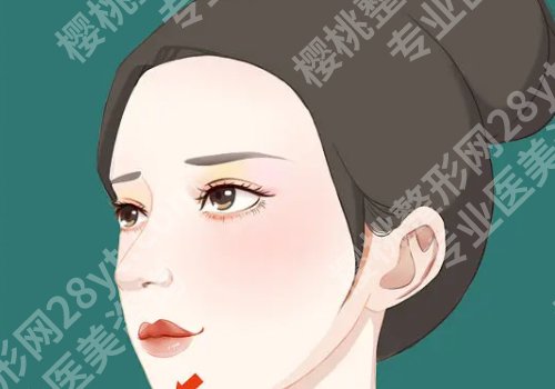 歪鼻矫正要多少钱?所受到的影响因素有哪些?