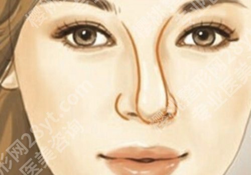 歪鼻矫正要多少钱?所受到的影响因素有哪些?