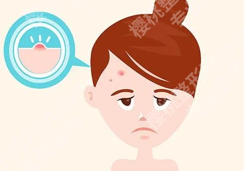 睡眠面膜哪种好用?这些面膜都备受大众热捧
