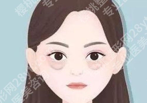 做眼袋一般需要多少钱?影响价格的因素有哪些?