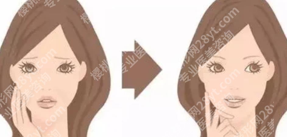 轮廓固定的利弊是什么?做轮廓整形手术要花多少钱?