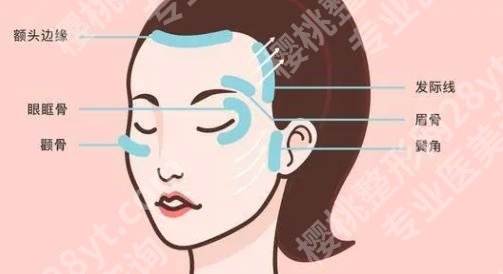 筋膜悬吊面部提升和线雕哪个好?主要的区别是什么呢?价格表