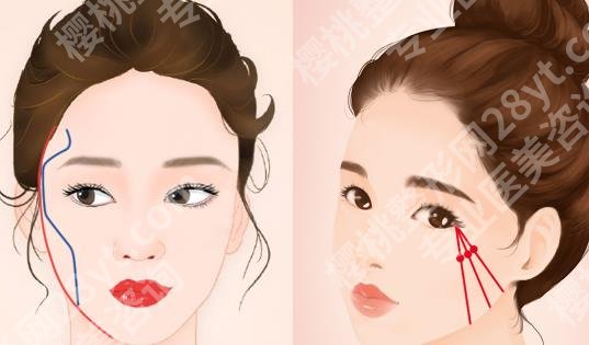 改脸型整容需要多少钱?改脸型的方式有几种?安全性如何
