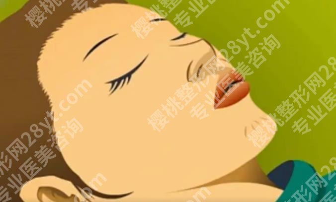 脸部填充一般需要多少钱?填充的材料有哪些?如何选择机构