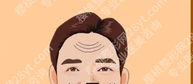 抬头纹怎么去除有效男生|注射除皱效果可靠吗?收费表曝光