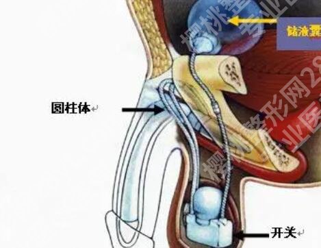 玻尿酸男性增大注射要多少钱?有什么需要注意的事项吗?
