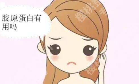 胶原蛋白注射能维持多久?效果好不好?来看详细介绍