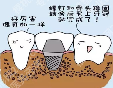 种植牙一颗价格大概是是多少?其价格也会因多种因素而有所不同!