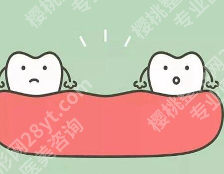 做牙冠大概多少钱一颗?牙冠的价格在每颗几百到数千元不等!