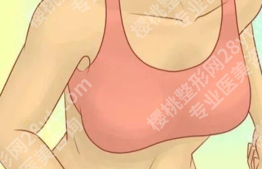 玻尿酸丰胸可以保持多长时间?原理及注意事项汇总!