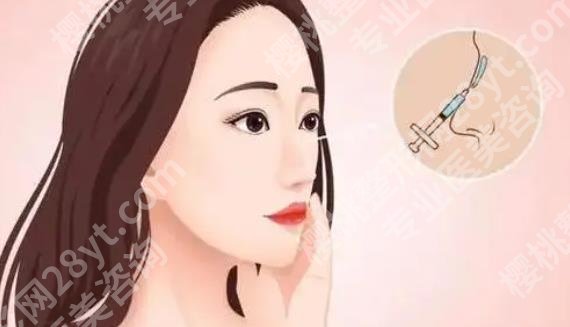 上海星璨门诊部杨杰怎么样?杨医生做双眼皮的全过程记录贴曝光!