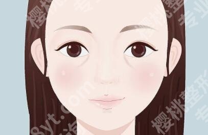 医美填充都有哪些材料?哪种材料填充比较好?收藏再看