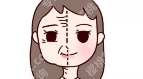 轮廓固定用什么品牌玻尿酸?哪种效果比较好?戳进来看