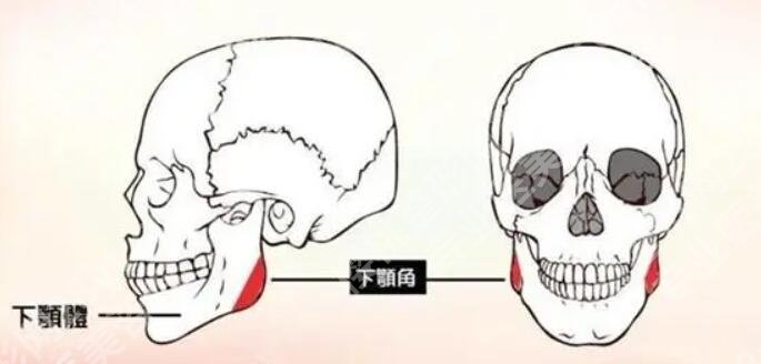 脸部骨骼不对称怎么矫正?手术方法有哪些?安全吗?
