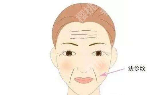 括号纹怎么去掉?有什么好的方法?求推荐~