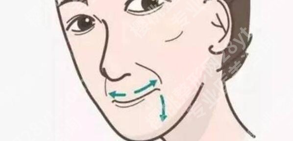 括号纹怎么去掉?有什么好的方法?求推荐~
