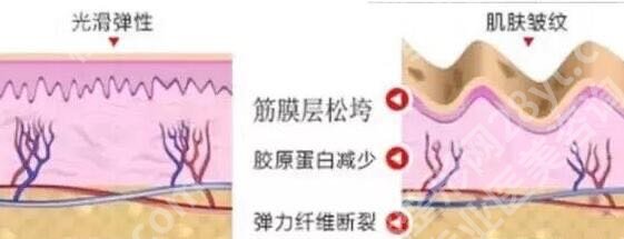 热玛吉一次多少钱?价格费用明细、功效作用揭晓!