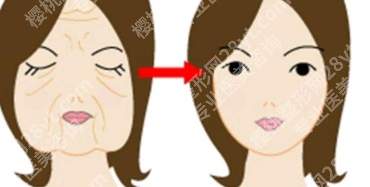 热玛吉的功效作用及副作用有什么?要注意哪些呢?