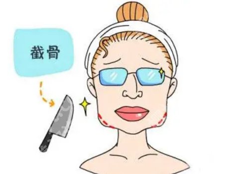 张笑天有磨骨资格吗?医生个人资料曝光