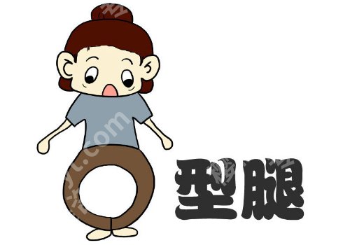 如何矫正o型腿?几种好的方法快快收藏起来!