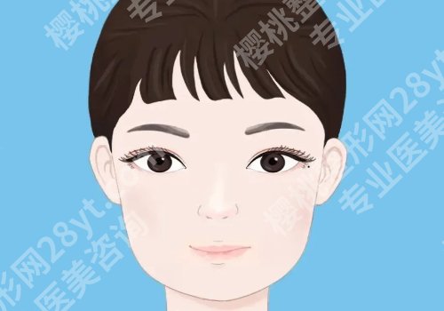 张笑天下颌角大概多少钱?医生案例与价格信息一览