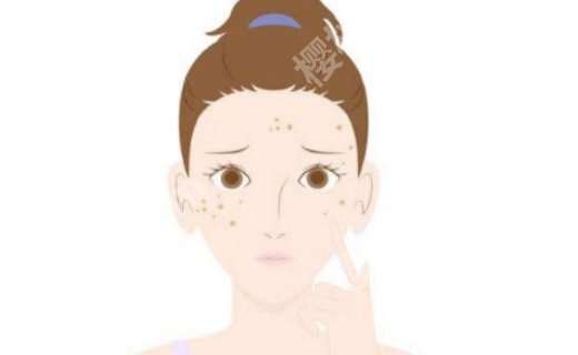 激光祛斑有用吗?多久恢复?