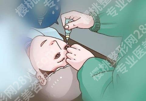 准分子激光近视手术原理是什么?有哪些优势和弊端