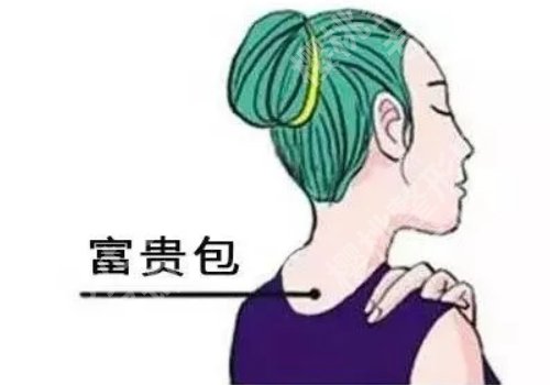 东方和谐冯斌做富贵包怎么样?内附医生手术案例!