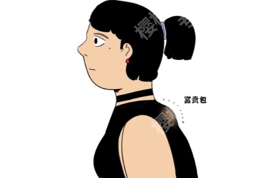 东方和谐冯斌做富贵包怎么样?内附医生手术案例!