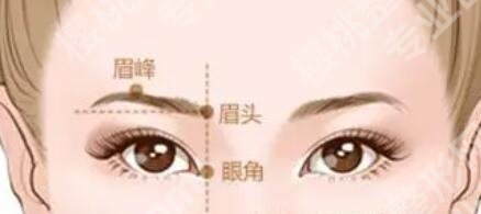 成都心悦容倪云志眉弓怎么样?真人隆眉弓效果图展示!