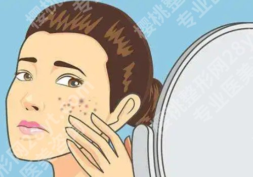 吃什么可以祛斑?祛斑养颜多吃这六种食物