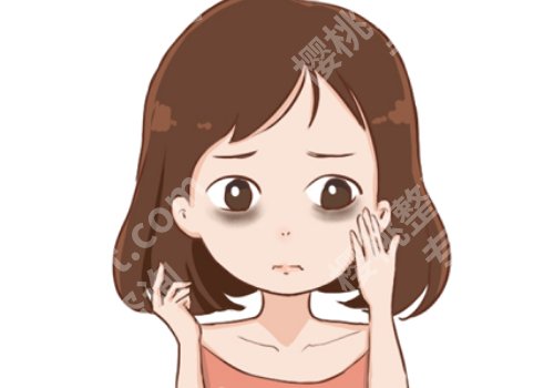 形成黑眼圈的原因是什么?9种因素影响,看看你中招了没!