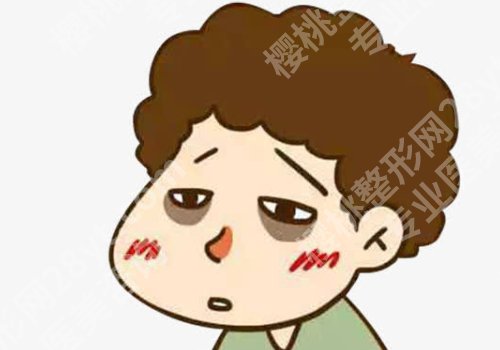形成黑眼圈的原因是什么?9种因素影响,看看你中招了没!