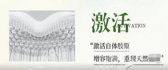 艾维岚注射后多久消肿?可以保持多久?附注意事项等介绍