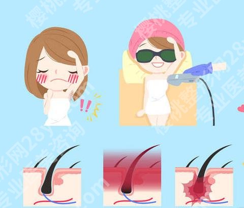 激光脱腋毛可以永久去除吗?优势、弊端等在线分析!