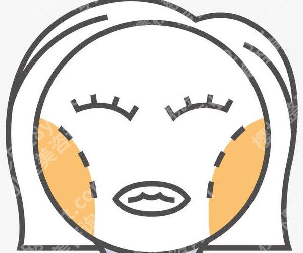 宋延刚吸脂案例图展示!真人恢复日记分享!就诊必看