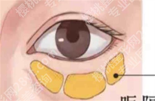 北京邦定美容林哲洪怎么样,口碑好吗,附案例