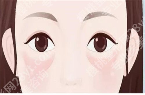 北京邦定美容林哲洪怎么样,口碑好吗,附案例