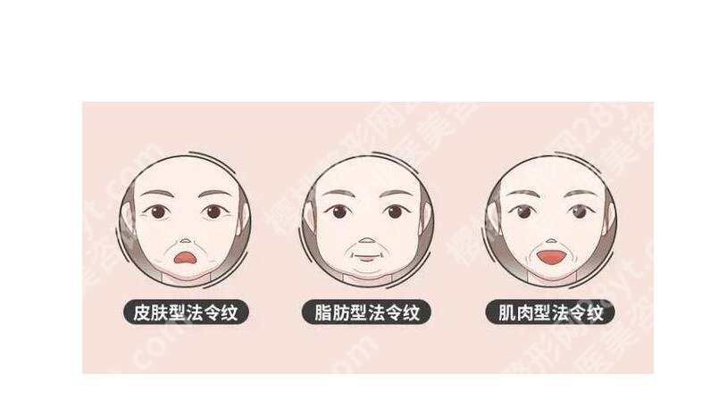 北京艺星医疗美容医院郭敬松医生怎么样?医生简介、法令纹改良案例一览!