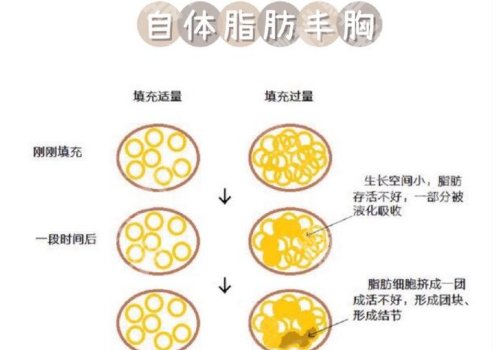 北京美莱医疗美容医院隆胸价格贵吗?医生信息及价格表分享!