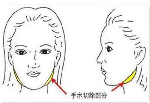 北京圣嘉荣医疗美容医院是几级资质?全面解析等你看